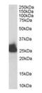 Triosephosphate Isomerase 1 antibody, orb66482, Biorbyt, Western Blot image 