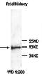 NPHS2 Stomatin Family Member, Podocin antibody, orb77373, Biorbyt, Western Blot image 