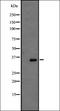 G Protein-Coupled Receptor 146 antibody, orb335535, Biorbyt, Western Blot image 