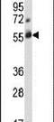 Cbl Proto-Oncogene C antibody, PA5-11356, Invitrogen Antibodies, Western Blot image 