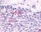 Adhesion G Protein-Coupled Receptor L2 antibody, NLS1133, Novus Biologicals, Immunohistochemistry paraffin image 