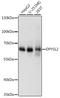 Dihydropyrimidinase Like 2 antibody, LS-C749567, Lifespan Biosciences, Western Blot image 