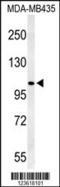 Transient Receptor Potential Cation Channel Subfamily M Member 3 antibody, LS-C160233, Lifespan Biosciences, Western Blot image 