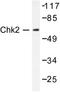 Checkpoint Kinase 2 antibody, LS-C176270, Lifespan Biosciences, Western Blot image 