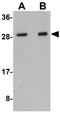 LYR motif-containing protein 1 antibody, GTX31407, GeneTex, Western Blot image 