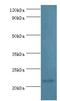 Peroxiredoxin 1 antibody, LS-C376410, Lifespan Biosciences, Western Blot image 