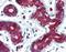 TPD52 Like 1 antibody, GTX85818, GeneTex, Immunohistochemistry paraffin image 