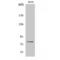 Protein Kinase C Delta antibody, LS-C381447, Lifespan Biosciences, Western Blot image 