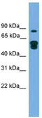 MTOR Associated Protein, Eak-7 Homolog antibody, TA344746, Origene, Western Blot image 