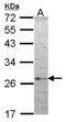 NME/NM23 Family Member 5 antibody, TA308136, Origene, Western Blot image 