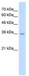 RAGE antibody, TA346144, Origene, Western Blot image 