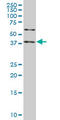 Salvador Family WW Domain Containing Protein 1 antibody, LS-C139346, Lifespan Biosciences, Western Blot image 