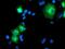 Proteasome 26S Subunit, Non-ATPase 2 antibody, MA5-25637, Invitrogen Antibodies, Immunocytochemistry image 