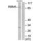 RNA Binding Motif Protein 5 antibody, A03559, Boster Biological Technology, Western Blot image 