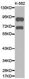 G Protein-Coupled Receptor Kinase 3 antibody, LS-C192685, Lifespan Biosciences, Western Blot image 