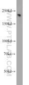 Neurofilament Heavy antibody, 21471-1-AP, Proteintech Group, Western Blot image 