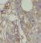 RAN Guanine Nucleotide Release Factor antibody, FNab07107, FineTest, Immunohistochemistry paraffin image 