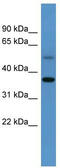 Glycogenin-1 antibody, TA346720, Origene, Western Blot image 