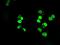 SATB Homeobox 1 antibody, GTX83679, GeneTex, Immunofluorescence image 