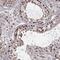 TATA-Box Binding Protein Associated Factor 13 antibody, NBP1-92474, Novus Biologicals, Immunohistochemistry paraffin image 