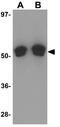 Forkhead Box O4 antibody, GTX31808, GeneTex, Western Blot image 
