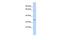 NmrA Like Redox Sensor 1 antibody, PA5-44899, Invitrogen Antibodies, Western Blot image 