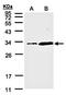 Phosphatidylinositol Transfer Protein Alpha antibody, orb73630, Biorbyt, Western Blot image 