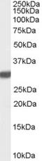 Latexin antibody, EB07682, Everest Biotech, Western Blot image 