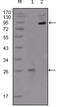 EPH Receptor B2 antibody, M01507, Boster Biological Technology, Western Blot image 
