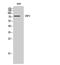 Guanylate Binding Protein 4 antibody, A11011-2, Boster Biological Technology, Western Blot image 