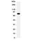 ADAM Metallopeptidase Domain 2 antibody, R31180, NSJ Bioreagents, Western Blot image 