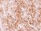 Creatine Kinase, Mitochondrial 1B antibody, NBP2-16005, Novus Biologicals, Immunohistochemistry frozen image 