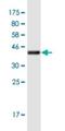 Zinc Finger Protein 875 antibody, H00284459-M06-100ug, Novus Biologicals, Western Blot image 