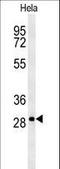 Transmembrane Protein 165 antibody, LS-C161930, Lifespan Biosciences, Western Blot image 