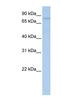 Glycogen Phosphorylase B antibody, NBP1-54966, Novus Biologicals, Western Blot image 