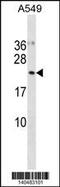 Ubiquitin-Fold Modifier Conjugating Enzyme 1 antibody, MBS9209638, MyBioSource, Western Blot image 