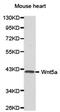 Wnt Family Member 5A antibody, PA5-76066, Invitrogen Antibodies, Western Blot image 