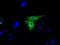 Glucose-6-Phosphate Isomerase antibody, GTX84416, GeneTex, Immunofluorescence image 