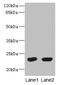 Ubiquitin Conjugating Enzyme E2 T antibody, CSB-PA878841LA01HU, Cusabio, Western Blot image 