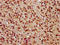 Poly(ADP-Ribose) Polymerase Family Member 3 antibody, LS-C681003, Lifespan Biosciences, Immunohistochemistry paraffin image 