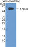 Programmed Cell Death 1 antibody, LS-C314610, Lifespan Biosciences, Western Blot image 