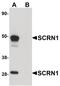 Secernin 1 antibody, PA5-20992, Invitrogen Antibodies, Western Blot image 