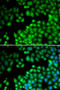 Lysine Methyltransferase 2E antibody, STJ27895, St John