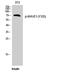 WASP Family Member 1 antibody, A02114Y125-1, Boster Biological Technology, Western Blot image 