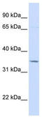 Toll Interacting Protein antibody, TA329401, Origene, Western Blot image 