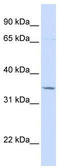 TOLIP antibody, TA329401, Origene, Western Blot image 