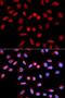 Protein Phosphatase 1 Catalytic Subunit Alpha antibody, LS-B13867, Lifespan Biosciences, Immunofluorescence image 