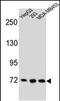 Zinc Finger Protein 860 antibody, PA5-48268, Invitrogen Antibodies, Western Blot image 