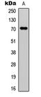 Coagulation Factor XI antibody, LS-C354357, Lifespan Biosciences, Western Blot image 
