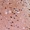 Elongation factor G, mitochondrial antibody, LS-C668883, Lifespan Biosciences, Immunohistochemistry paraffin image 